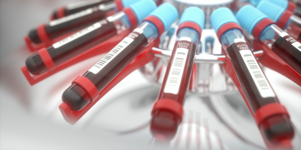 Blood Centrifuge Machine