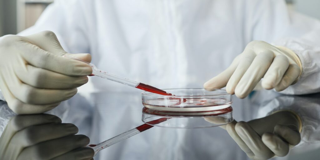 Blood Tests in Biotech Laboratory